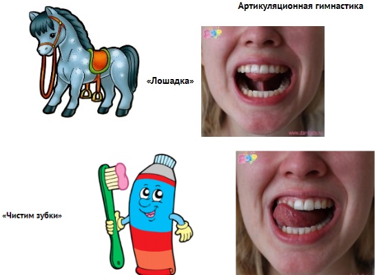 Артикуляционные упражнения "Лошадка", "Чистим зубки"