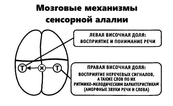 Крестиком показано нарушение связи при сенсорной алалии
