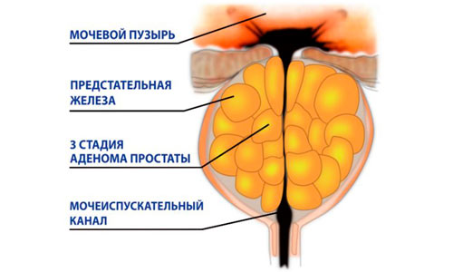 Консультация у врача Консультация у врача
