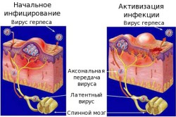 Механизм заражения человека герпесом Механизм заражения человека герпесом