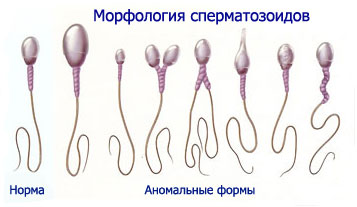 Морфология сперматозоидов Морфология сперматозоидов