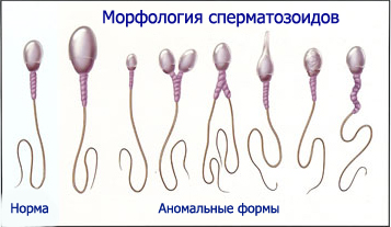 Морфология сперматозоидов Морфология сперматозоидов