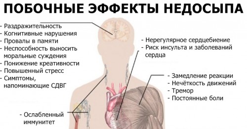 Побочные эффекты недосыпания Побочные эффекты недосыпания