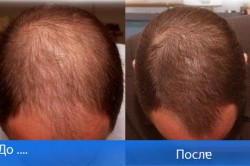 Результаты применения Результаты применения