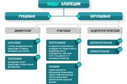 Виды алопеции Виды алопеции