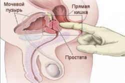 Ручной массаж простаты Ручной массаж простаты