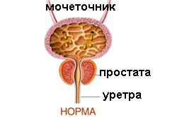 Простата в норме Простата в норме