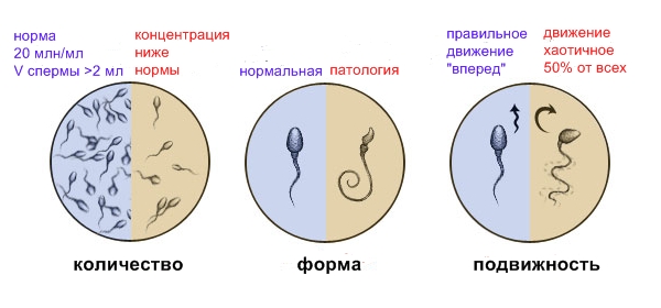 Спермограмма Спермограмма