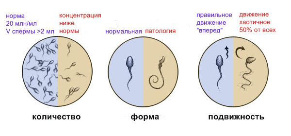 Спермограмма Спермограмма