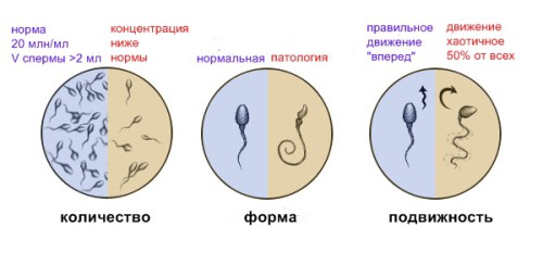 Оценка качества спермы по спермограмме Оценка качества спермы по спермограмме