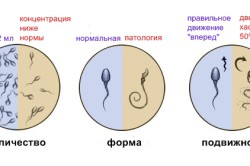 Оценка качества спермы на спермограмме Оценка качества спермы на спермограмме
